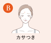 B