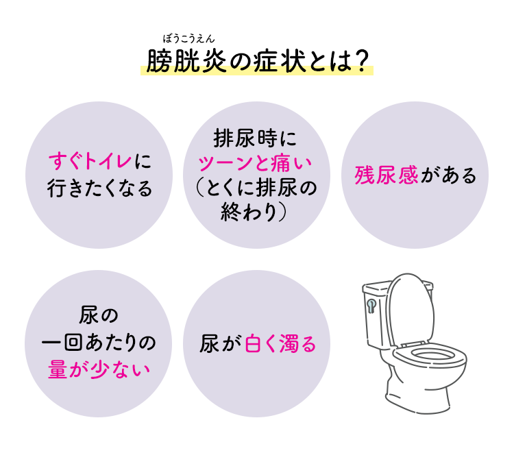 膀胱炎の症状とは？ すぐトイレに行きたくなる 排尿時にツーンと痛い（とくに排尿の終わり） 残尿感がある 尿の一回あたりの量が少ない 尿が白く濁る
