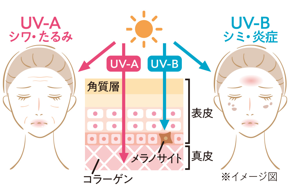 紫外線による肌のダメージのイメージ