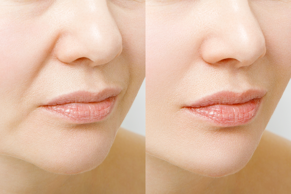 日焼けによる老化を防ぐ