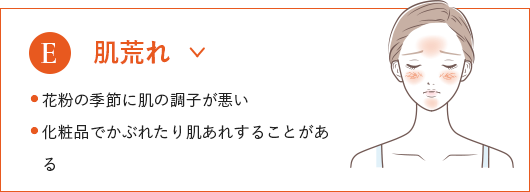 
                              肌荒れ
                              ● 花粉の季節に肌の調子が悪い
                              ● 化粧品でかぶれたり肌あれすることがある
                              