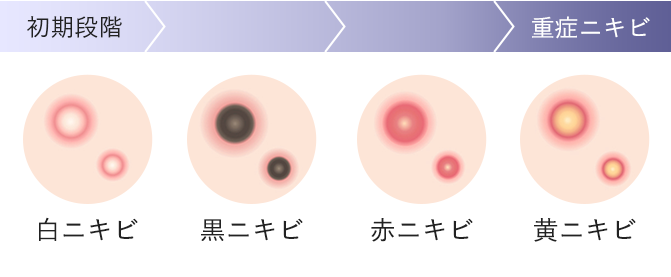 グリチルリチン酸2K イメージ