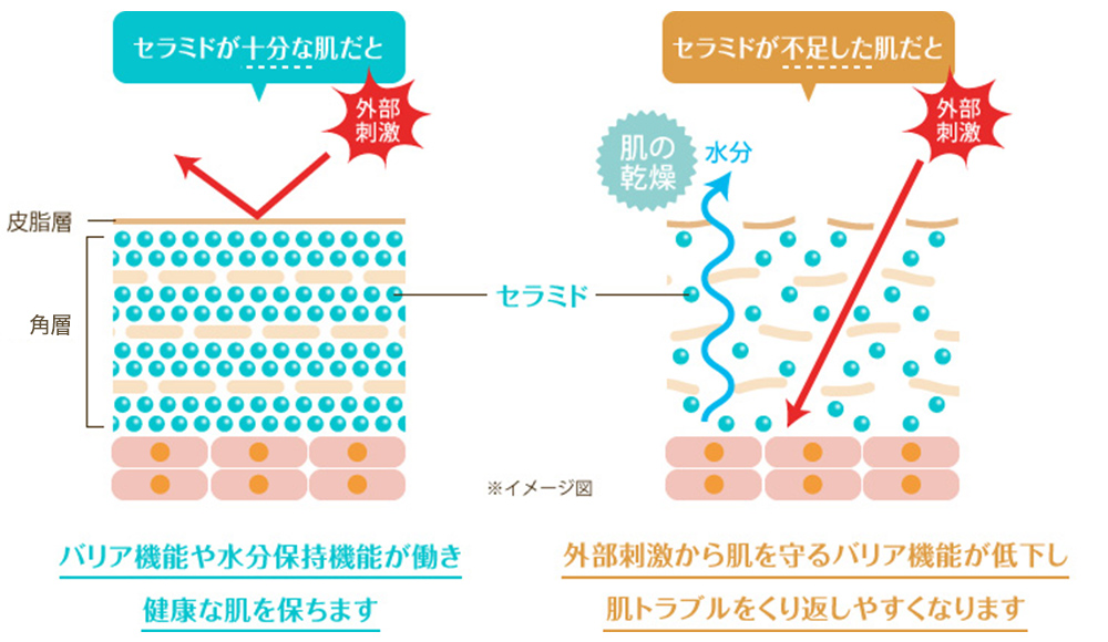 角層の図