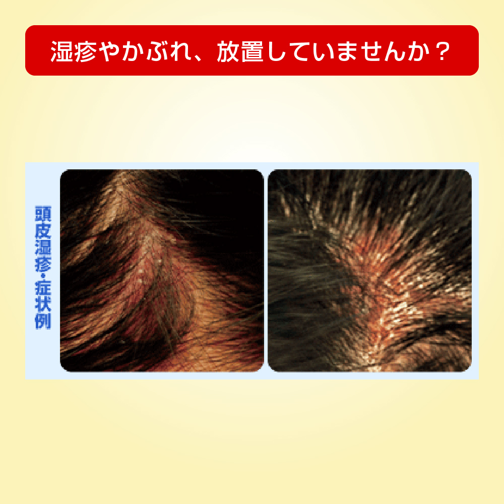 【指定第2類医薬品】メンソレータム メディクイックHゴールド（スポンジヘッド）