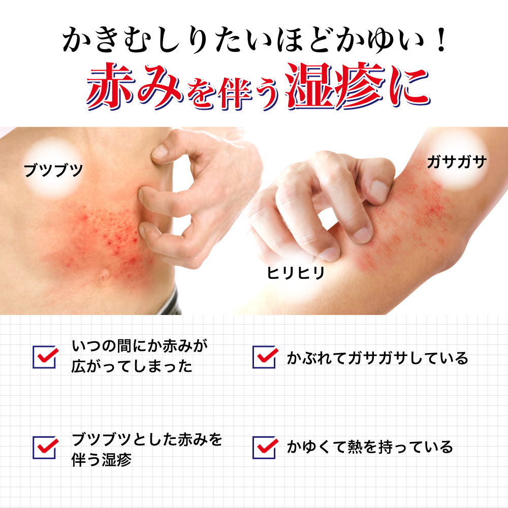 【指定第2類医薬品】メンソレータムメディクイックプロ軟膏