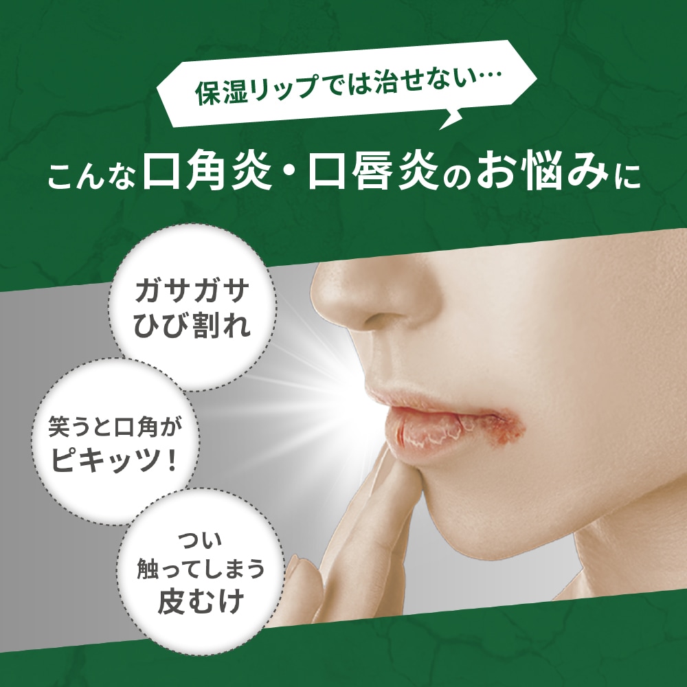 【第3類医薬品】メンソレータム メディカルリップ ヒビプロ